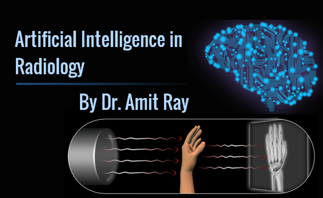 Artificial Intelligence in Radiology
